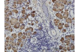 Immunoperoxidase of monoclonal antibody to HIPK1 on formalin-fixed paraffin-embedded human salivary gland.