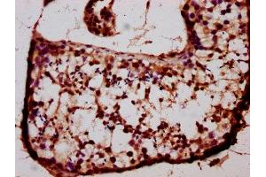 IHC image of ABIN7145250 diluted at 1:400 and staining in paraffin-embedded human testis tissue performed on a Leica BondTM system.