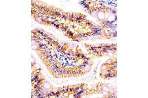 (ABIN6242231 and ABIN6578095) staining (Mouse) Epcam in mouse colon sections by Immunohistochemistry (IHC-P - paraformaldehyde-fixed, paraffin-embedded sections). (EpCAM antibody  (C-Term))