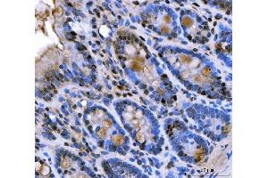 IHC analysis of U1A/SNRPA using anti-U1A/SNRPA antibody (ABIN7600891). (SNRPA1 antibody  (AA 25-218))