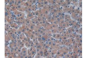 Detection of PKR in Human Liver Tissue using Polyclonal Antibody to Protein Kinase R (PKR) (EIF2AK2 antibody  (AA 224-502))