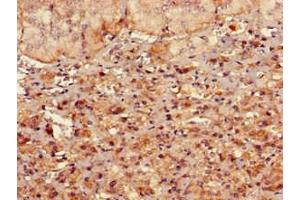 Immunohistochemistry of paraffin-embedded human adrenal gland tissue using ABIN7167713 at dilution of 1:100 (RMND1 antibody  (AA 35-160))