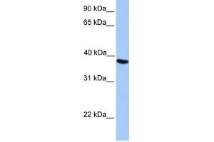 WB Suggested Anti-NAT6 Antibody Titration:  0. (NAT6 antibody  (C-Term))