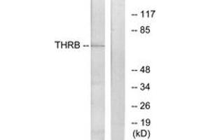 Western blot analysis of extracts from NIH-3T3 cells, using THRB Antibody. (THRB antibody  (AA 391-440))