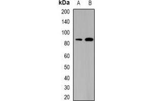 Western blot analysis of SATB1 expression in THP1 (A), mouse thymus (B) whole cell lysates. (SATB1 antibody)