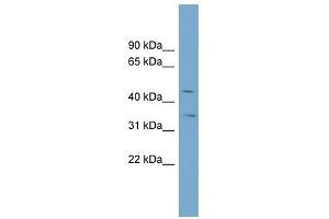 SLC39A8 antibody used at 1 ug/ml to detect target protein.