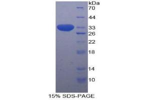SDS-PAGE analysis of Human STAT1 Protein. (STAT1 Protein)