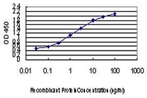 Detection limit for recombinant GST tagged ZIC4 is approximately 0. (ZIC4 antibody  (AA 249-319))