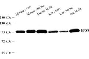 Western blot analysis of EPS8 (ABIN7073852) at dilution of 1: 500 (EPS8 antibody)
