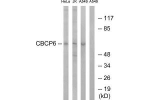 Western Blotting (WB) image for anti-ATP/GTP Binding Protein-Like 4 (AGBL4) (C-Term) antibody (ABIN1851213) (AGBL4 antibody  (C-Term))