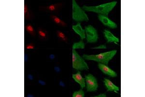 Phospho-CtIP (Thr847) Antibody staining A549 cells(H2O2 treatment) by IF/ICC.