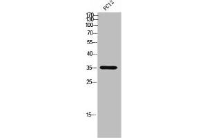 Western Blot analysis of PC12 cells using CD298 Polyclonal Antibody (ATP1B3 antibody  (C-Term))