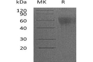 Western Blotting (WB) image for Interleukin 2 Receptor, gamma (IL2RG) protein (His tag) (ABIN7320814)