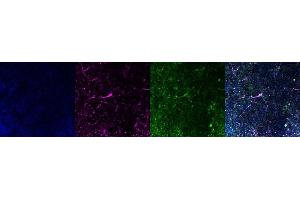 Immunohistochemistry (IHC) image for anti-Ionized Calcium-binding Adapter Molecule 1 (IBA1) antibody (ABIN7456154) (Iba1 antibody)