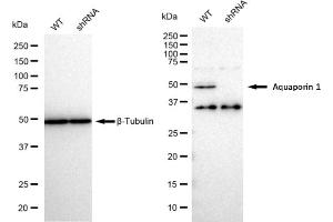 Western blotting analysis using Aquaporin 1 antibody (ABIN7797637). (Recombinant Aquaporin 1 antibody)