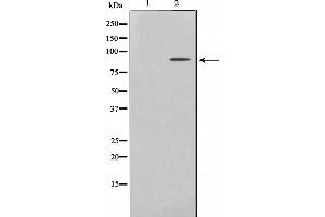 Western blot analysis on HeLa cell lysate using ES8L2 Antibody,The lane on the left is treated with the antigen-specific peptide. (EPS8-Like 2 antibody  (N-Term))