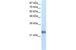 Western Blotting (WB) image for anti-Ring Finger Protein 114 (RNF114) antibody (ABIN2460666) (RNF114 antibody)