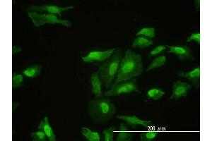 Immunofluorescence of monoclonal antibody to FHL2 on HeLa cell.