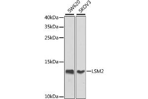 Western blot analysis of extracts of various cell lines, using LSM2 antibody (ABIN6131870, ABIN6143358, ABIN6143359 and ABIN6224004) at 1:1000 dilution. (LSM2 antibody  (AA 1-95))