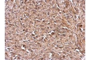 IHC-P Image Immunohistochemical analysis of paraffin-embedded RT2 xenograft, using TrxR1, antibody at 1:500 dilution. (TXNRD1 antibody)