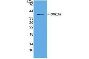 Detection of Recombinant EIF3A, Mouse using Polyclonal Antibody to Eukaryotic Translation Initiation Factor 3A (EIF3A) (EIF6 antibody  (AA 622-848))