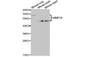 Western blot analysis of extracts of various cell lines, using MMP14 antibody. (MMP14 antibody)