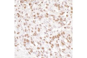 Immunohistochemistry (IHC) image for anti-Ewing Sarcoma Breakpoint Region 1 (EWSR1) (AA 100-150) antibody (ABIN7453905) (EWSR1 antibody  (AA 100-150))