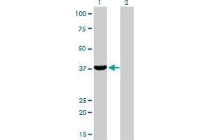 Western Blot analysis of AKR1C4 expression in transfected 293T cell line by AKR1C4 monoclonal antibody (M01), clone 2C11.
