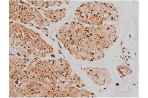 Immunohistochemistry (IHC) image for anti-Microtubule-Associated Protein tau (MAPT) (pSer262) antibody (ABIN6256228)