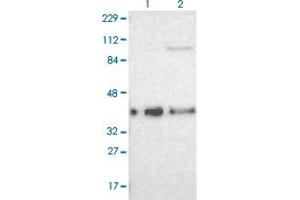 Western blot analysis of Lane 1: Human cell line RT-4 Lane 2: Human cell line U-251MG sp with CDKN1C polyclonal antibody  at 1:100-1:250 dilution.