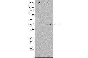 Western blot analysis of extracts from HuvEc cells, using SHB antibody. (SHB antibody  (C-Term))