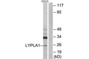 Western blot analysis of extracts from COLO cells, using LYPLA1 Antibody. (LYPLA1 antibody  (AA 51-100))