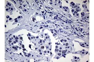 Image no. 1 for anti-Nibrin (NBN) (AA 183-460) antibody (ABIN1491067) (Nibrin antibody  (AA 183-460))