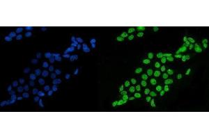 IF analysis of splicing factor 1 using anti-splicing factor 1 antibody (ABIN7600194). (Splicing Factor 1 antibody  (AA 160-266))