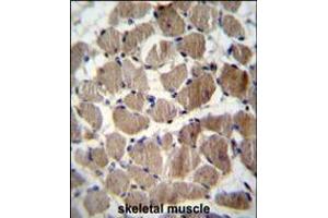 COCH Antibody immunohistochemistry analysis in formalin fixed and paraffin embedded human skeletal muscle followed by peroxidase conjugation of the secondary antibody and DAB staining. (COCH antibody  (AA 399-428))