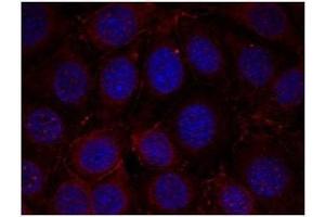 Image no. 1 for anti-Insulin-Like Growth Factor 1 Receptor (IGF1R) (pTyr1165), (pTyr1166) antibody (ABIN196775) (IGF1R antibody  (pTyr1165, pTyr1166))