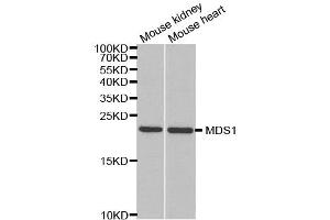 Western Blotting (WB) image for anti-MDS1 and EVI1 Complex Locus (MECOM) antibody (ABIN1876875) (MECOM antibody)