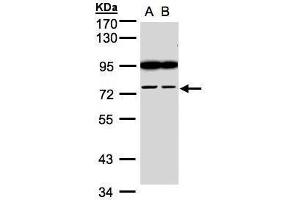 WB Image Sample(30 ug whole cell lysate) A:H1299 B:HeLa S3, 7. (FSD2 antibody  (N-Term))