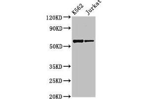 Western Blot Positive WB detected in: K562 whole cell lysate, Jurkat whole cell lysate All lanes: NAMPT antibody at 2. (NAMPT antibody  (AA 1-280))