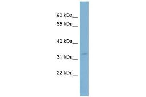 SLC25A20 antibody used at 1 ug/ml to detect target protein. (SLC25A20 antibody)