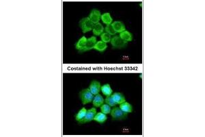 ICC/IF Image Immunofluorescence analysis of methanol-fixed A431, using AGAP3, antibody at 1:200 dilution. (AGAP3 antibody  (C-Term))