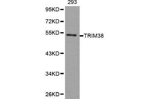 Western blot analysis of extracts of 293 cell line, using TRIM38 antibody. (TRIM38 antibody  (AA 266-465))