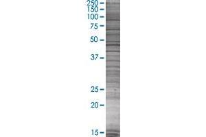 HSD11B1 transfected lysate. (HSD11B1 293T Cell Transient Overexpression Lysate(Denatured))