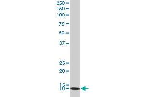 DNAJC19 polyclonal antibody (A01), Lot # 060608JCS1 Western Blot analysis of DNAJC19 expression in HL-60 . (DNAJC19 antibody  (AA 20-116))
