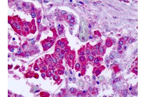 Anti-GRM7 / MGLUR7 antibody IHC of human adrenal. (GRM7 antibody  (N-Term))