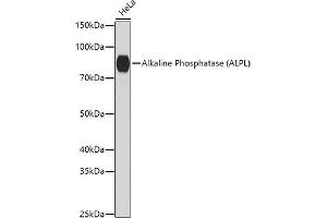 Western blot analysis of extracts of HeLa cells, using Alkaline Phosphatase (ALPL) antibody (ABIN6133557, ABIN6136824, ABIN6136825 and ABIN6216013) at 1:1000 dilution. (ALPL antibody  (AA 150-250))