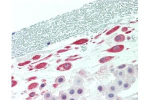 Human Placenta, Amnion: Formalin-Fixed, Paraffin-Embedded (FFPE) (TADA2L antibody  (Internal Region))