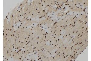 ABIN6273222 at 1/100 staining Mouse heart tissue by IHC-P. (CXXC5 antibody)