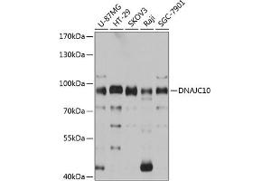 Western blot analysis of extracts of various cell lines, using DN antibody (ABIN6130306, ABIN6139717, ABIN6139719 and ABIN6215728) at 1:3000 dilution.