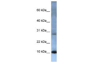WB Suggested Anti-ATP5G2 Antibody Titration:  0. (ATP5G2 antibody  (N-Term))